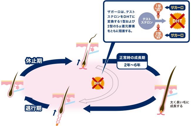 治療によるヘアサイクルの変化:DHT濃度の低下によりヘアサイクルの正常化を促す模式図
