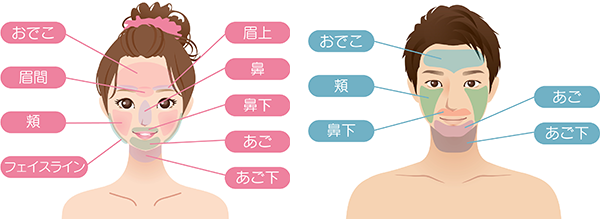 医療脱毛の対応部位（顔）の図