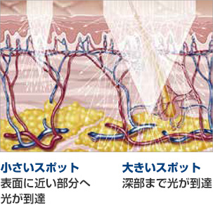 ライトシェアクアトロの大口径ハンドピースの説明図