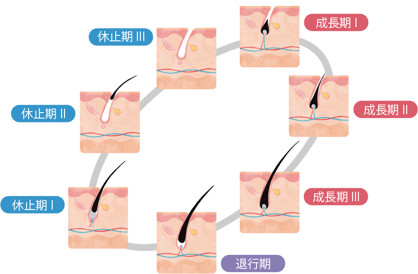 毛周期（成長期・退行期・休止期）と医療脱毛の関係の図