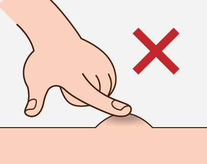 粉瘤を自分で潰す危険性のイメージ